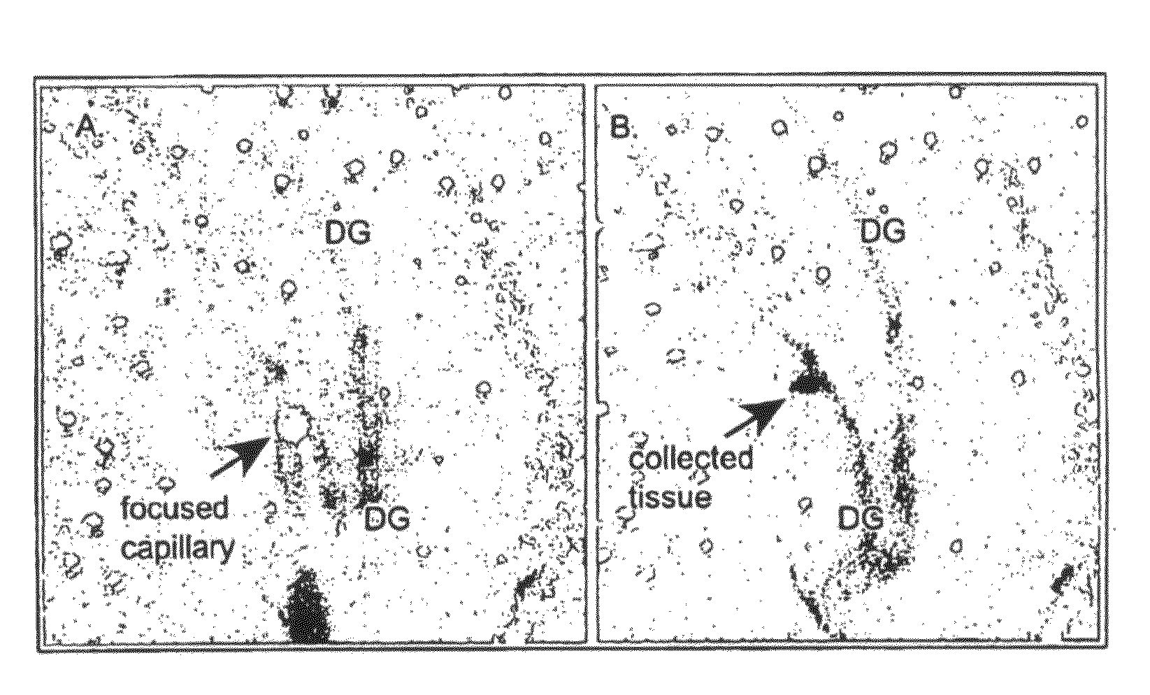 Capillary-based cell and tissue acquisition system (CTAS)