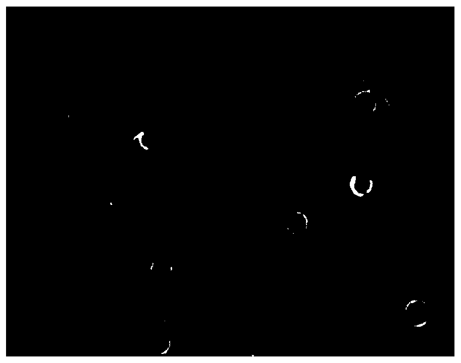 Method for preparing exosomes of mesenchymal stem cells