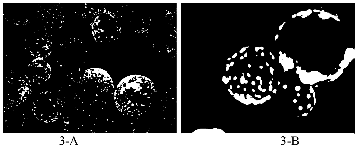 Method for preparing exosomes of mesenchymal stem cells