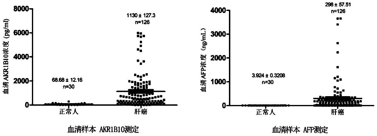 Kit for detecting liver cancer, hepatitis and/or liver cirrhosis and application of kit in AKR1B10 and AFP combined quantitative determination