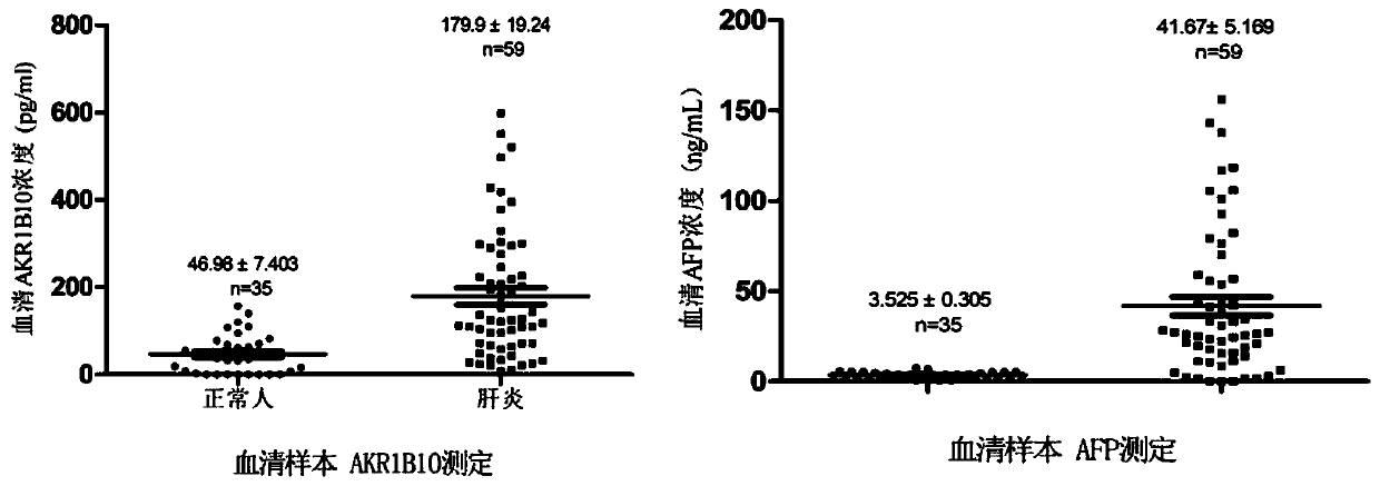 Kit for detecting liver cancer, hepatitis and/or liver cirrhosis and application of kit in AKR1B10 and AFP combined quantitative determination