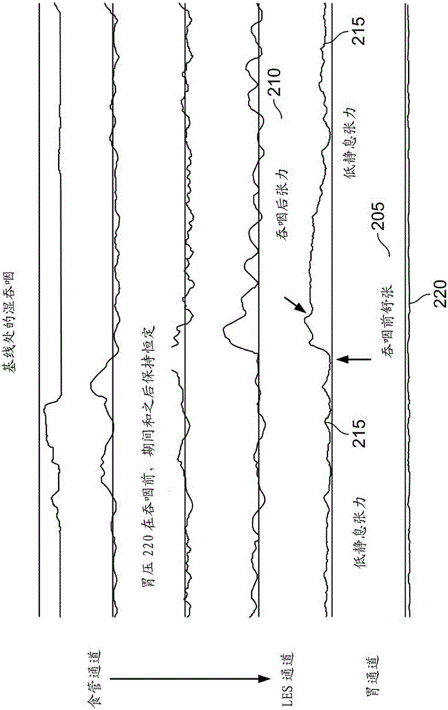 Systems and methods for electrical stimulation of biological systems