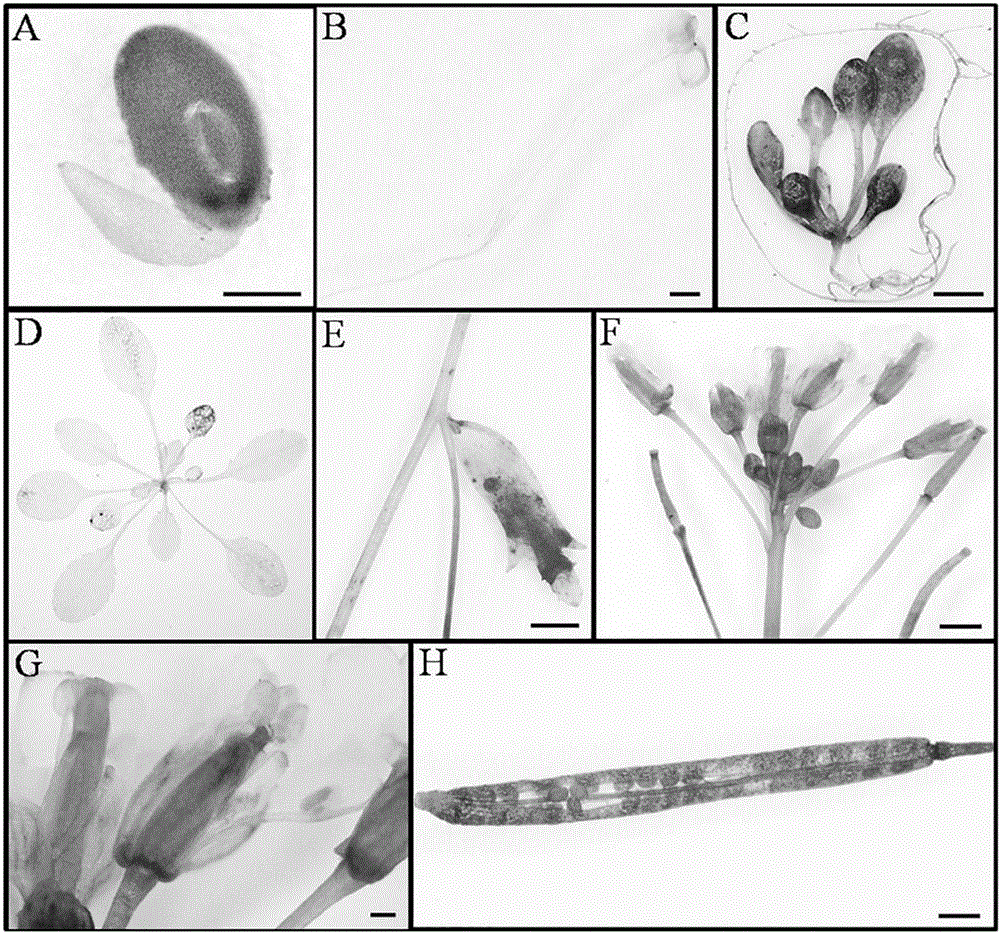 Wild vitis quinquangularis anti-disease gene and application thereof