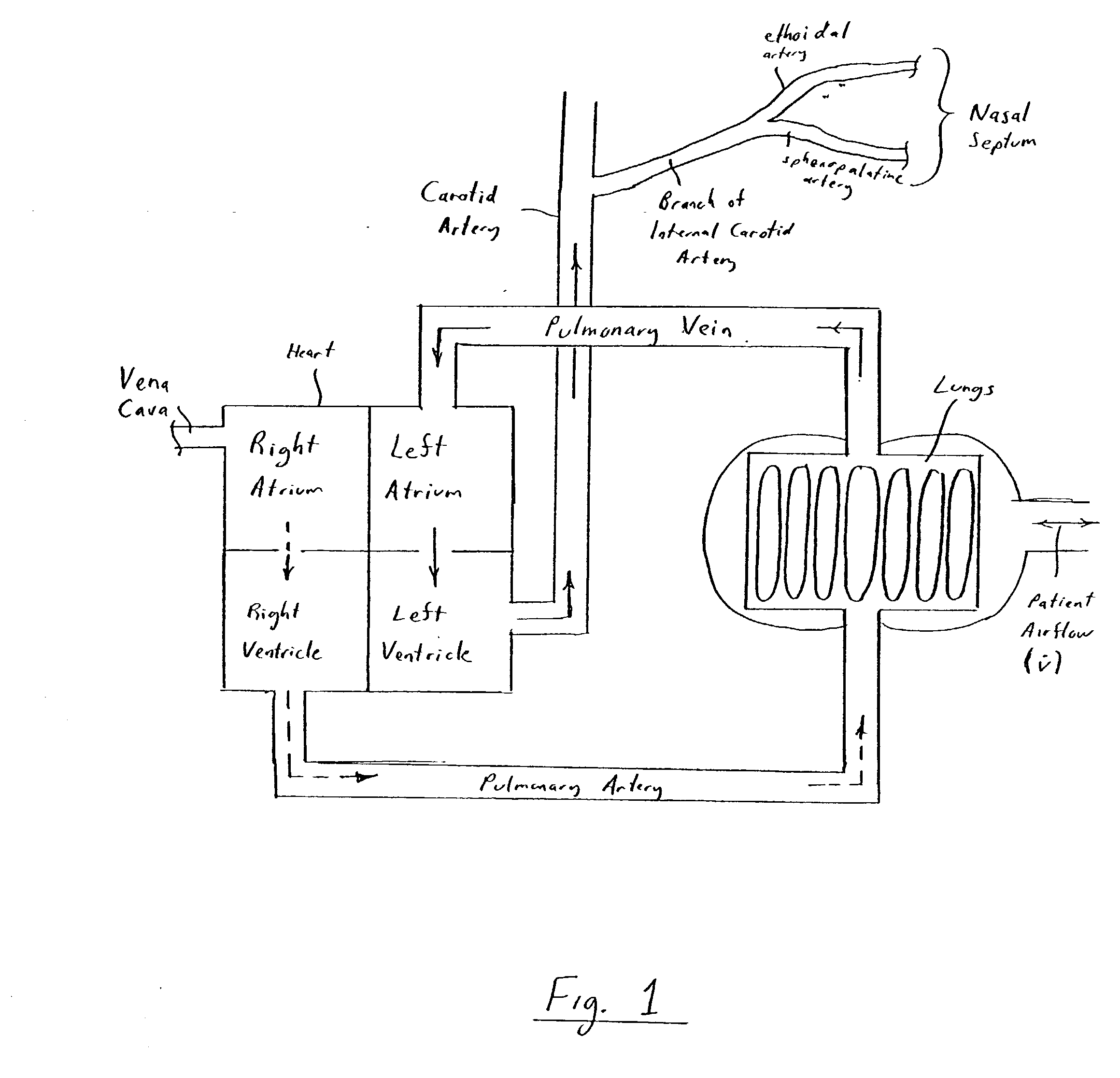 Method and apparatus for determining cardiac output