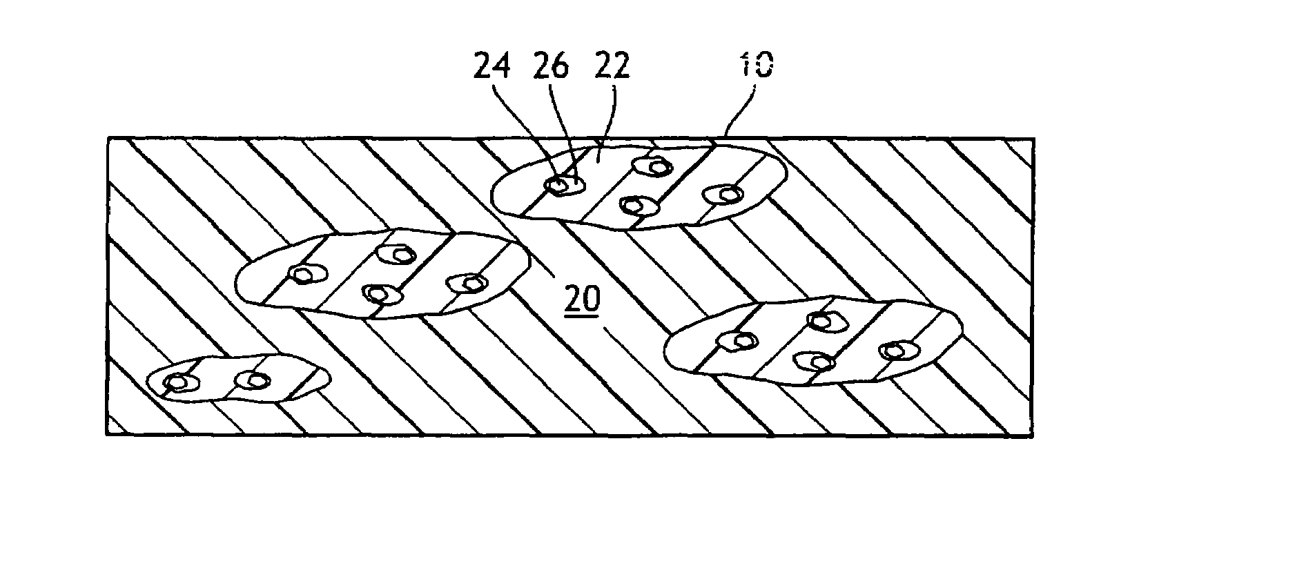 Microporous breathable elastic films, methods of making same, and limited use or disposable product applications