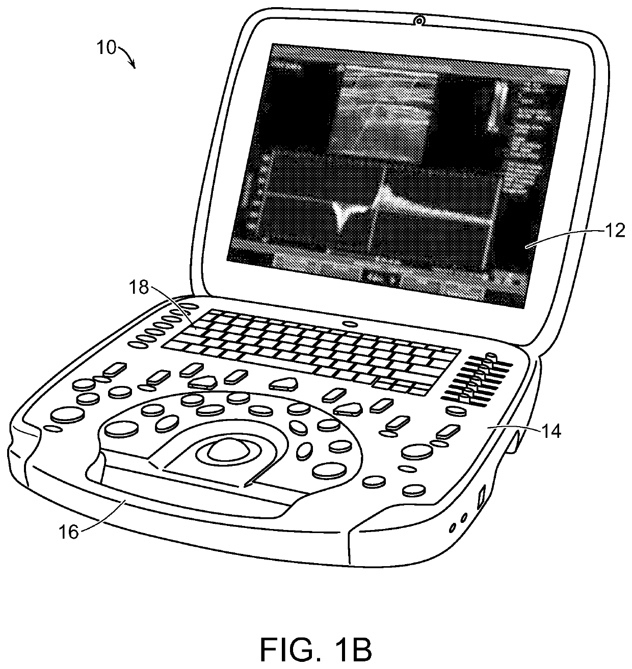 Portable ultrasound system