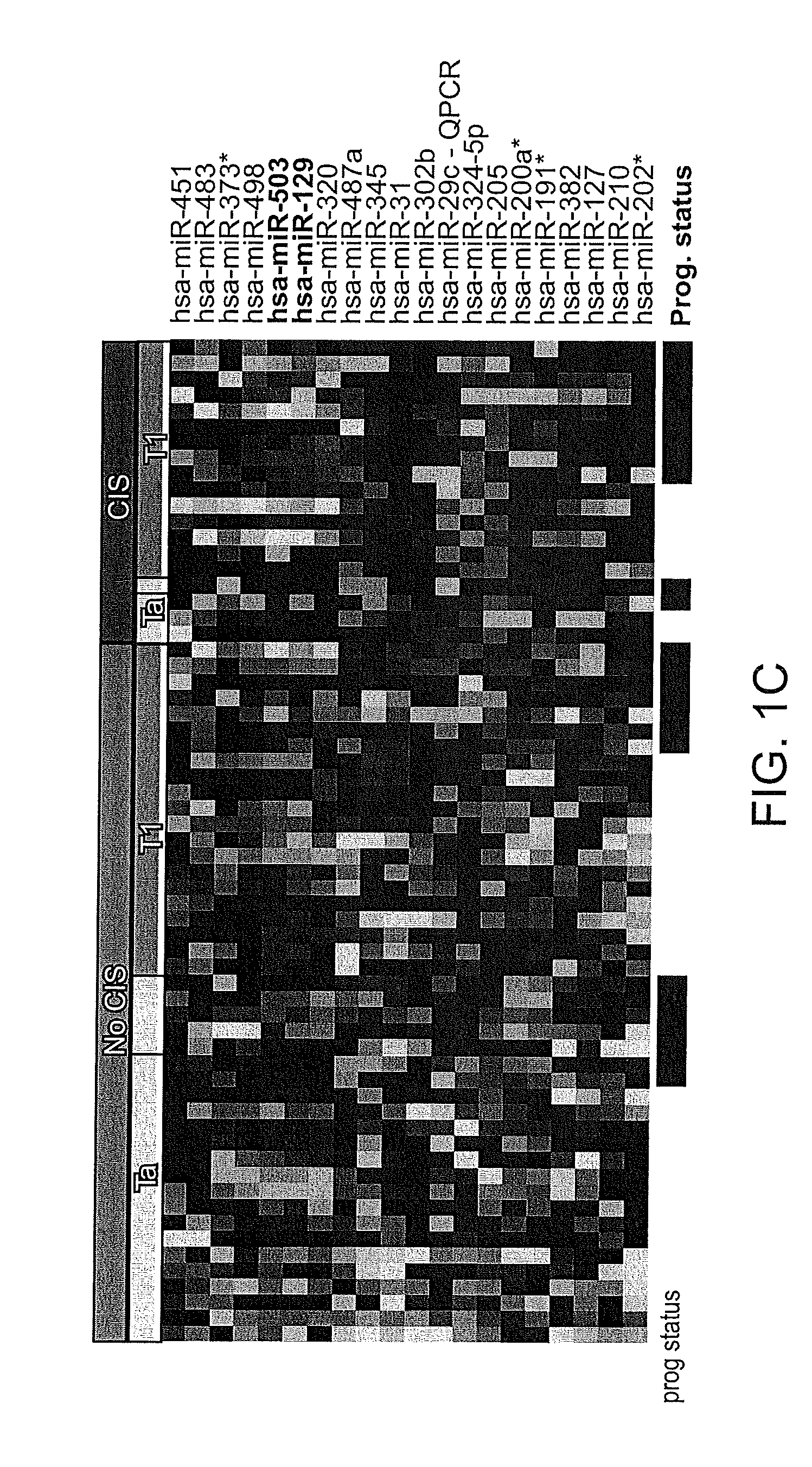 Diagnostic and prognostic use of human bladder cancer-associated micro rnas