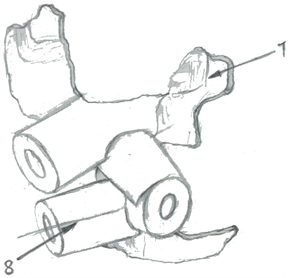 Artificial vertebra by anterior pedicle screw fixation and positioning assembly tool