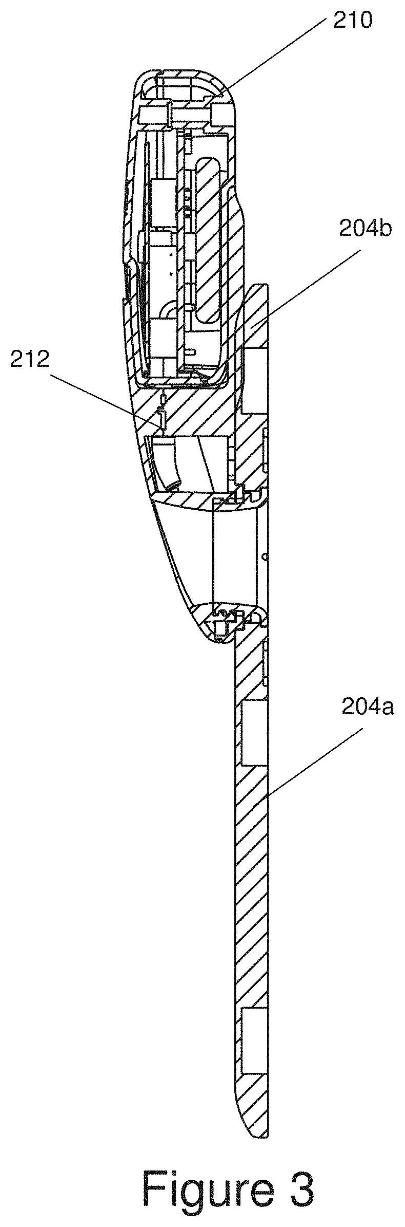 An apparatus for acquiring signals from a pregnant subject