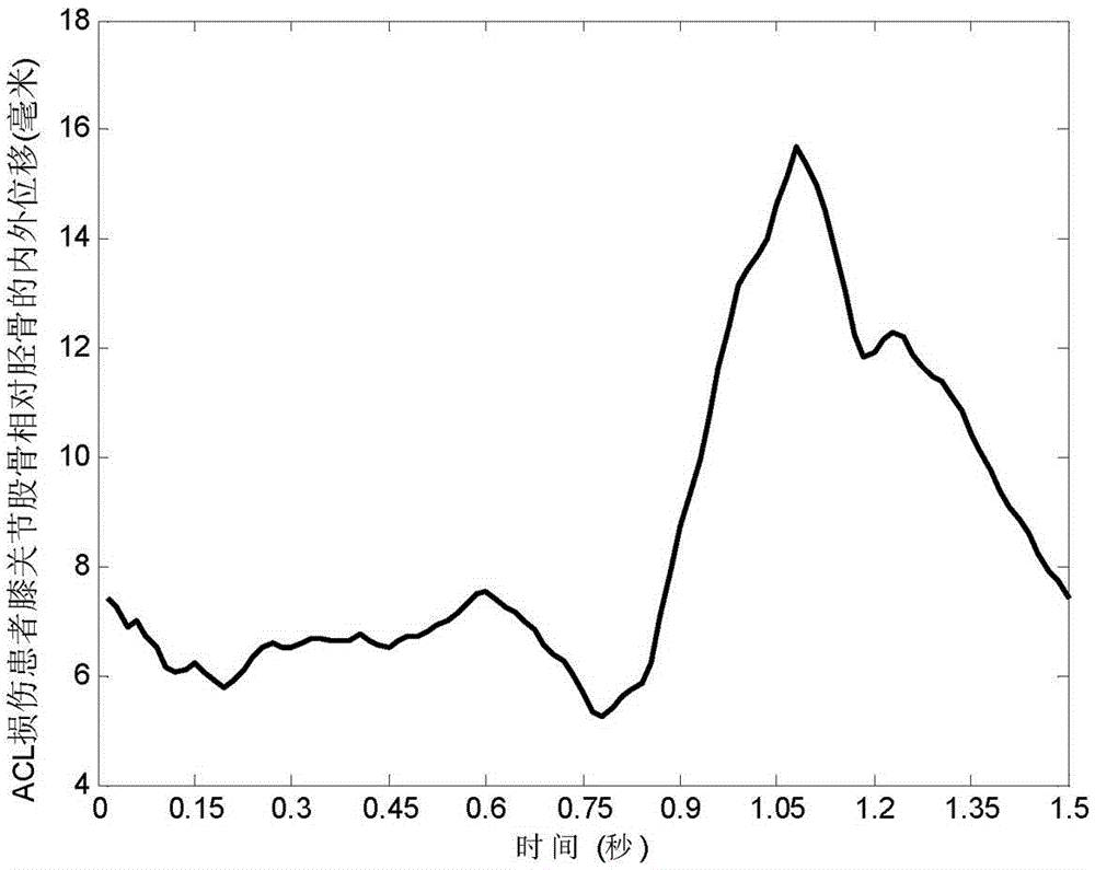 Gait analysis method for auxiliary screening of injury of anterior cruciate ligament