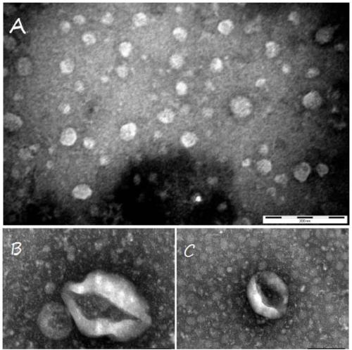 Method for separating exosomes by low-speed ultrafiltration centrifugation conjugated polymer precipitation technique