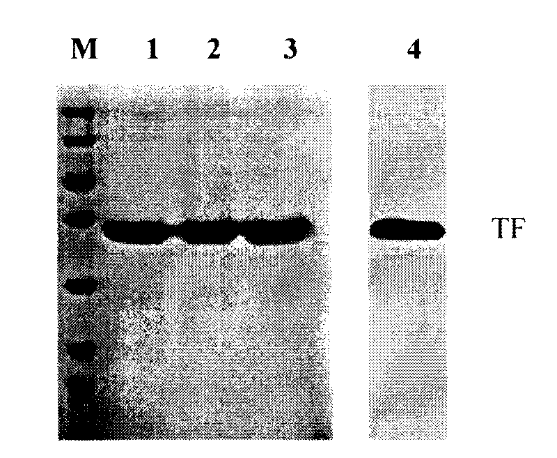 Method for preparing antihuman recombinant tissue factor monoclonal antibody