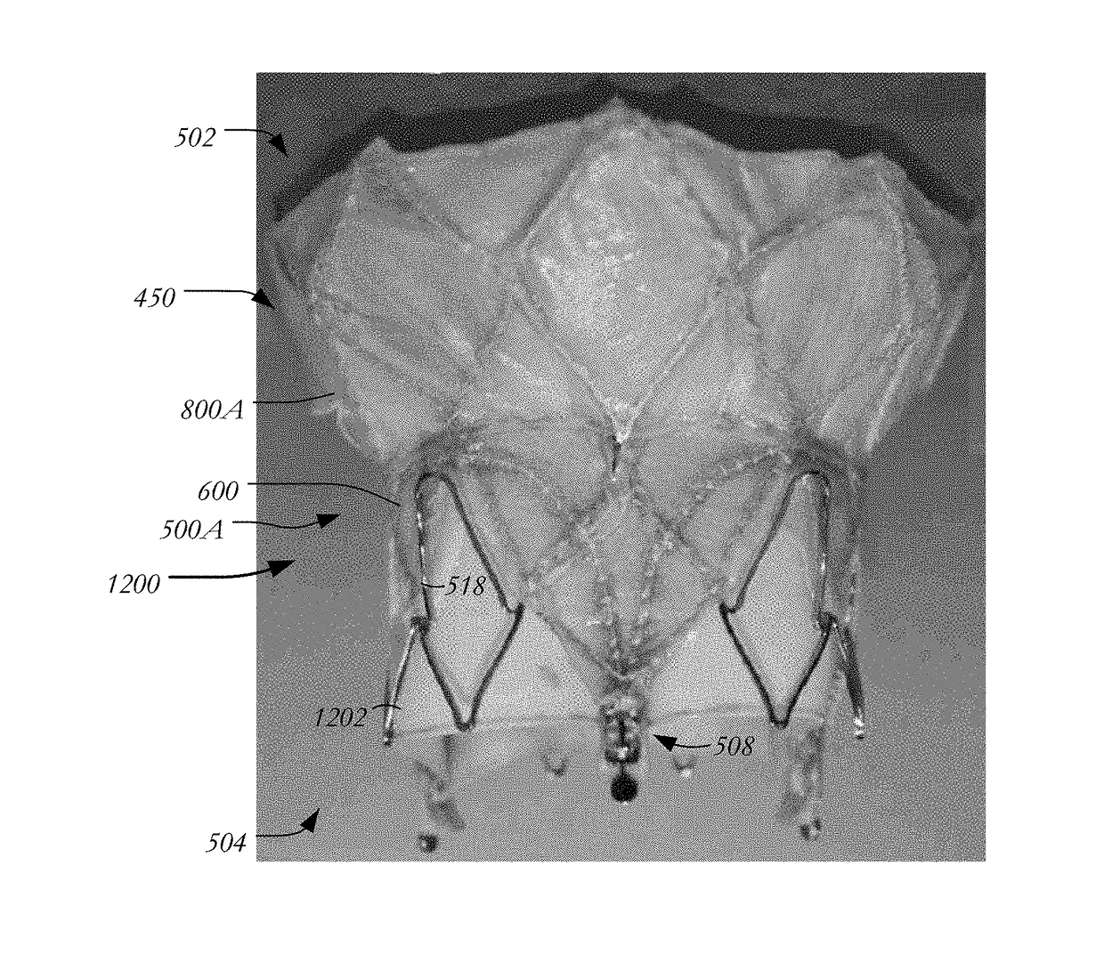 Mitral heart valve replacement