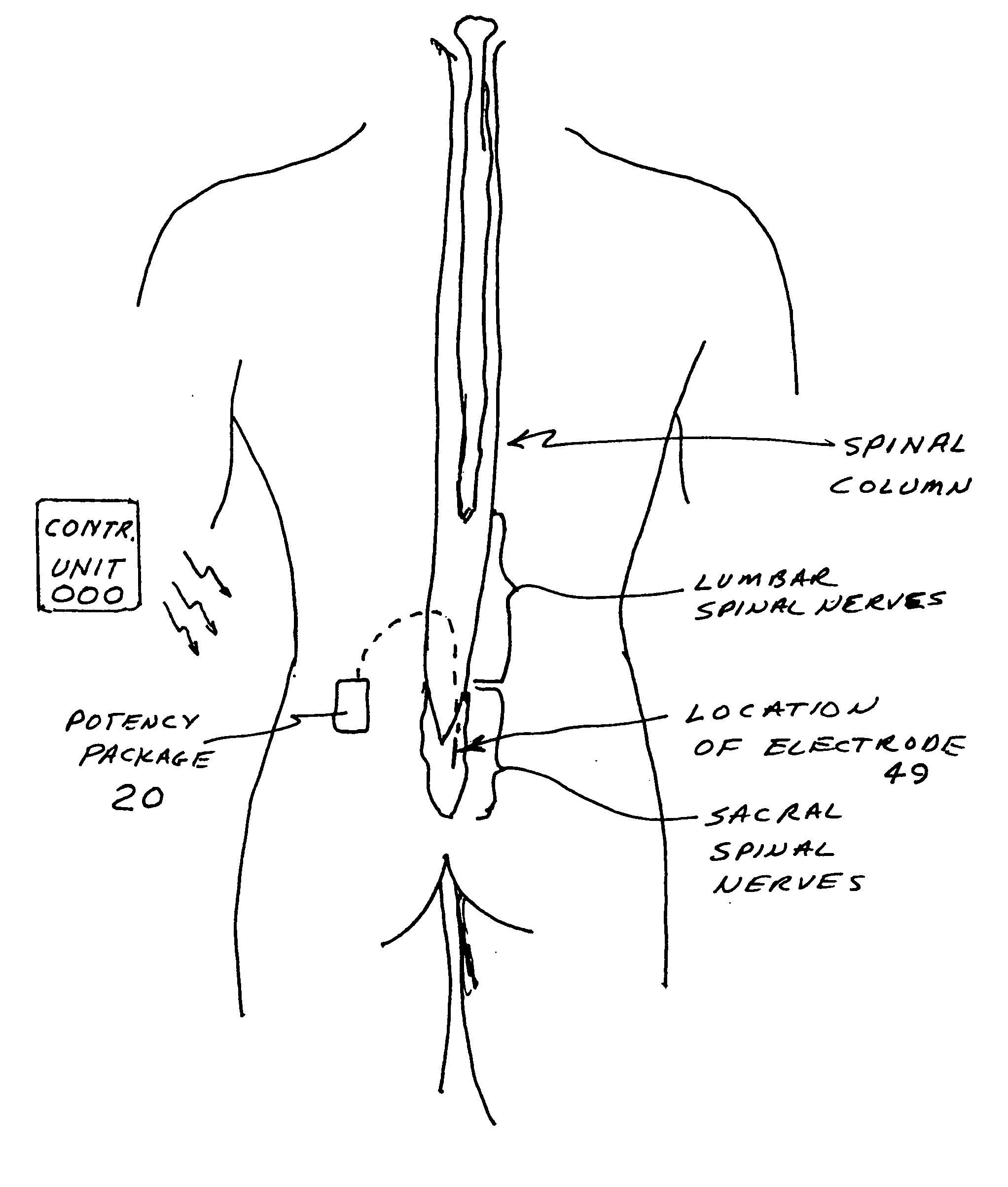 Potency package two