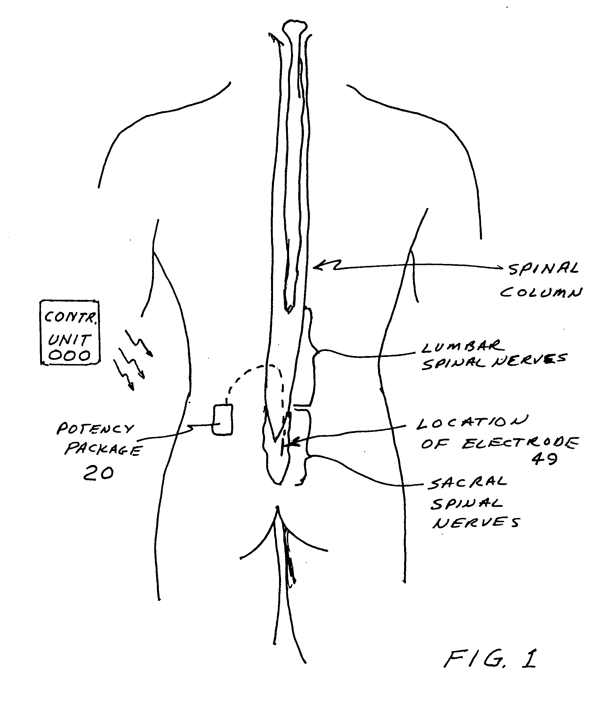 Potency package two