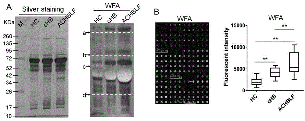 Lectin microarray for detecting carbohydrate chain marker based on protein in saliva, lectin microarray for detecting carbohydrate chain marker jointly based on protein in saliva and serum, kit and applications of lectin microarrays