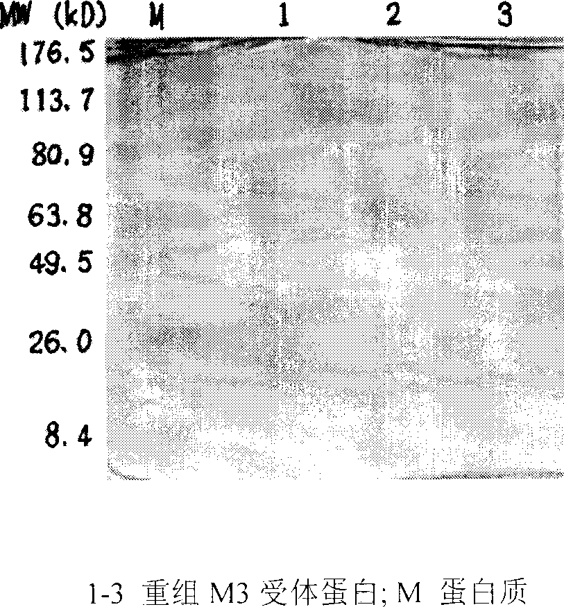 Use of anticholinergic M3-type receptor antibody determination for diagonsing sicca syndrome