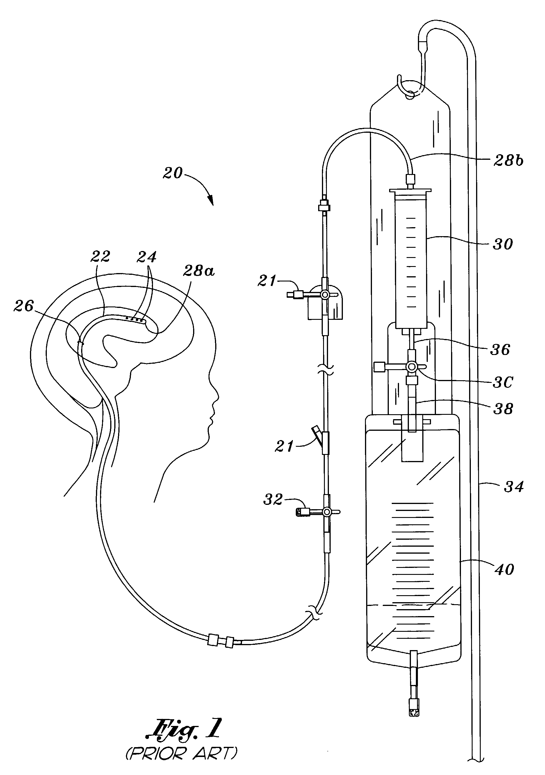 Portable pressure relief system & methods