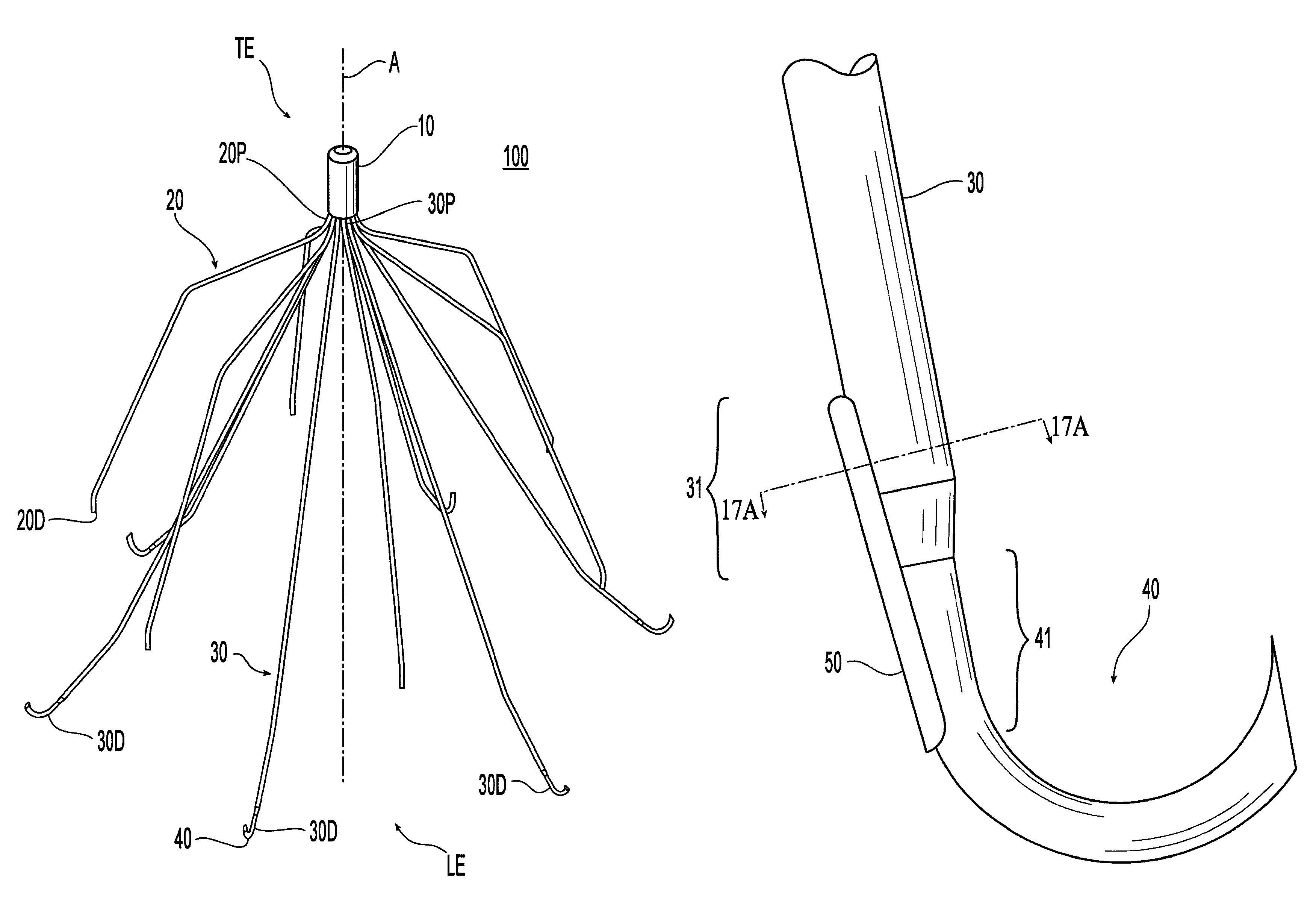 Removable blood clot filter with edge for cutting through the endothelium