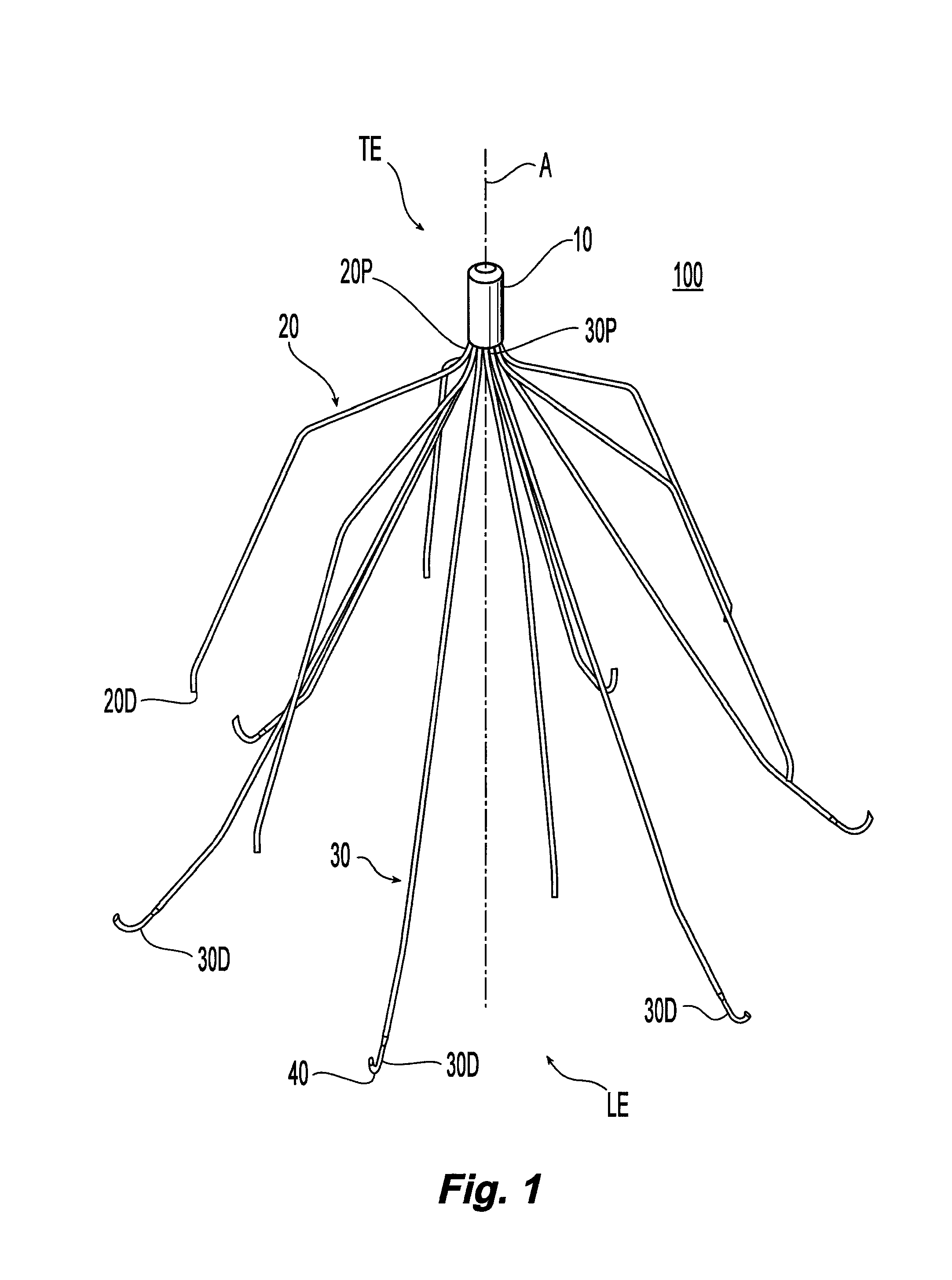 Removable blood clot filter with edge for cutting through the endothelium