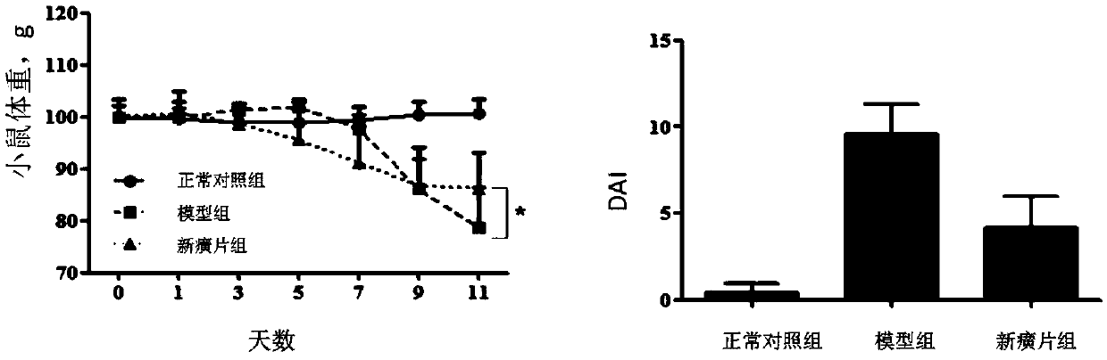 Application of Xinhuang tablet in preparation of medicine for treating ulcerative colitis