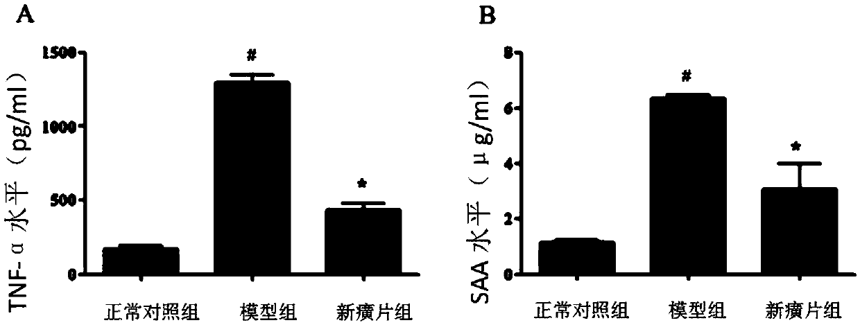 Application of Xinhuang tablet in preparation of medicine for treating ulcerative colitis