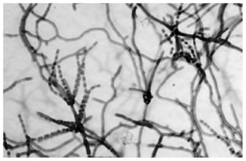 Isolated Streptomyces DL70 and biocontrol and growth promoting application thereof