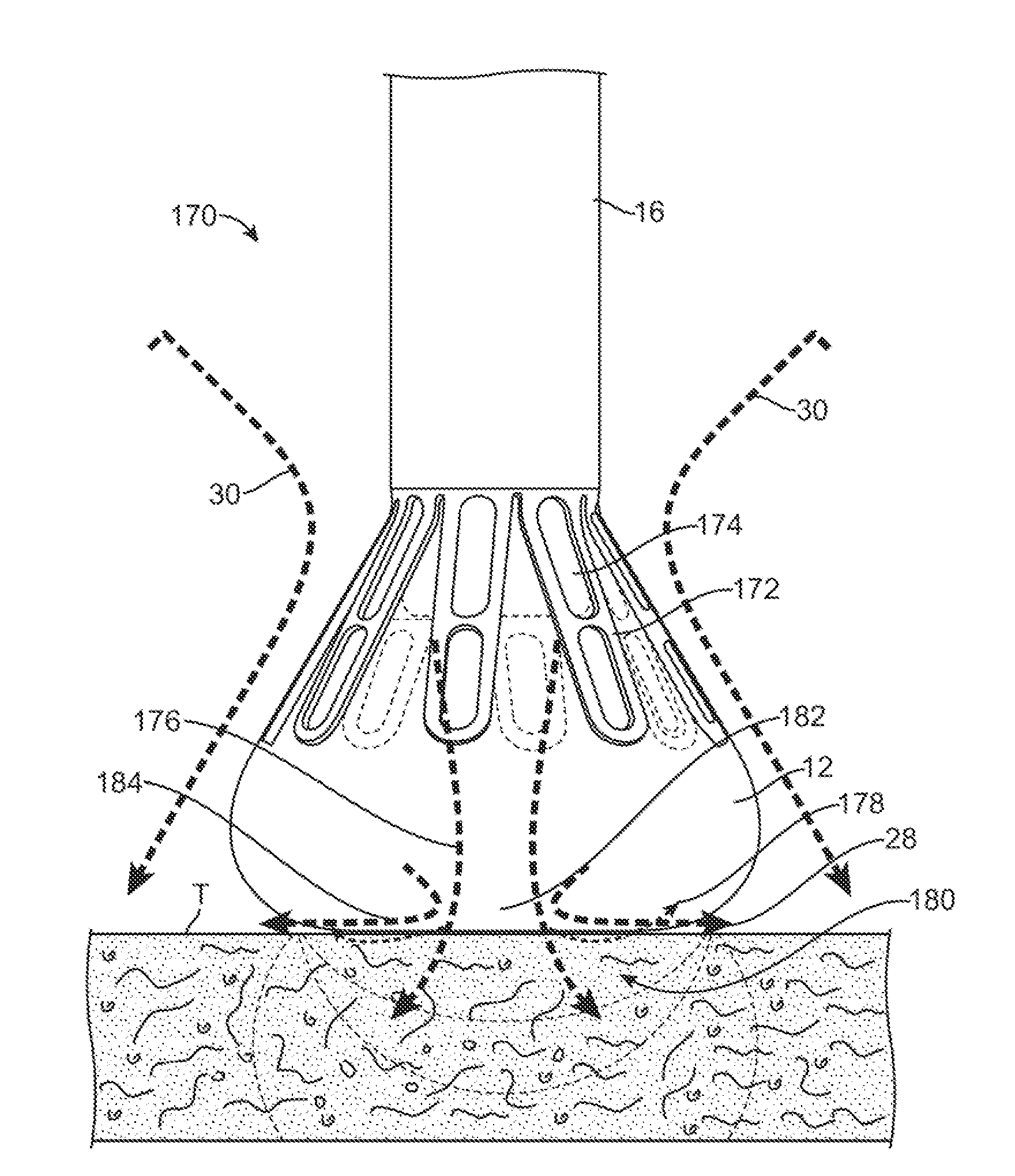 Visual electrode ablation systems