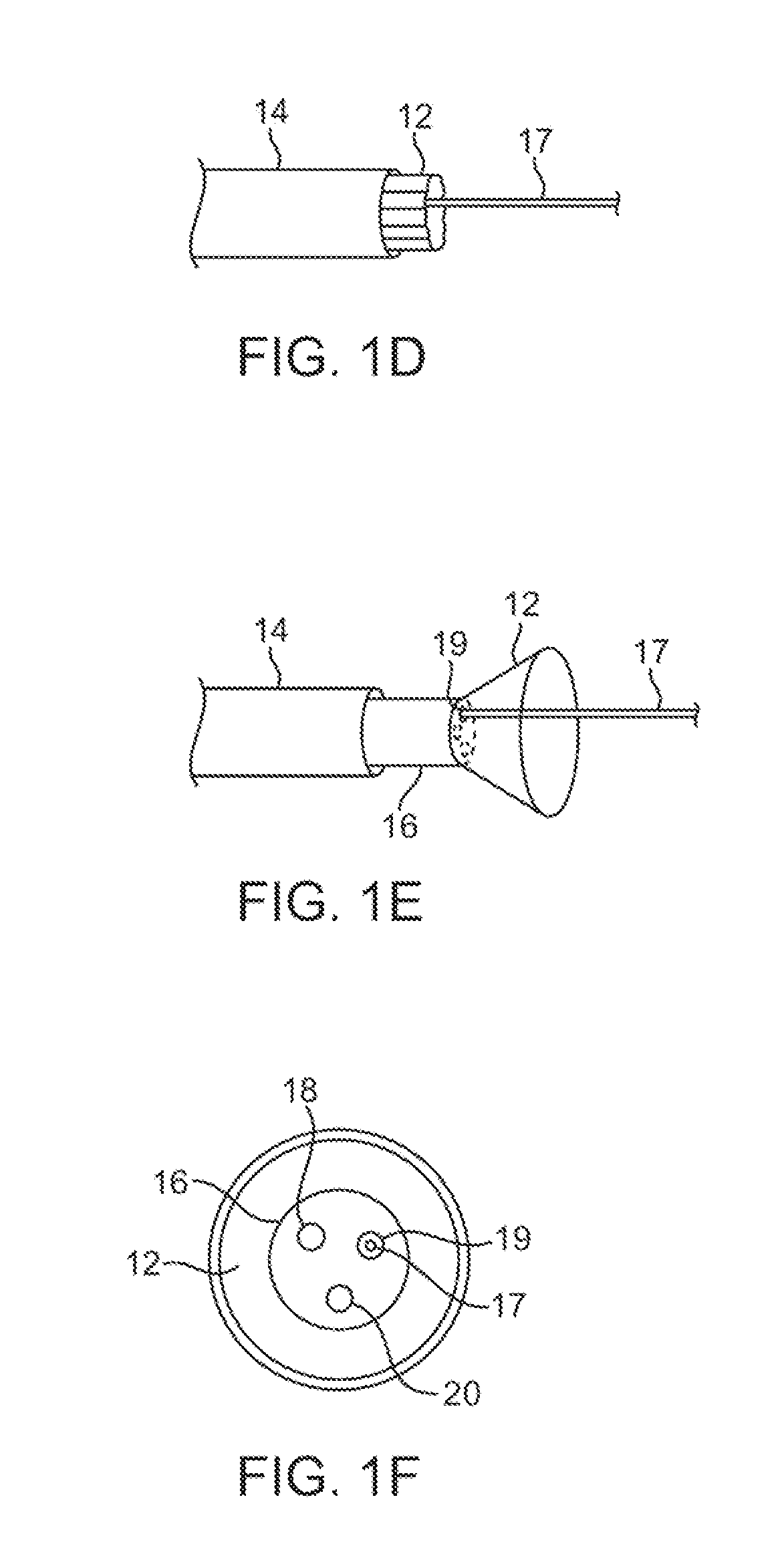 Visual electrode ablation systems