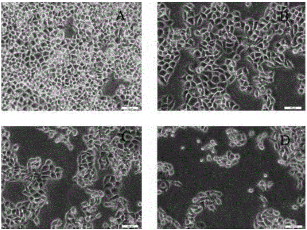 Use of pterostilbene in preparation of drugs for inhibiting liver cancer cell proliferation and inducing liver cancer cell apoptosis