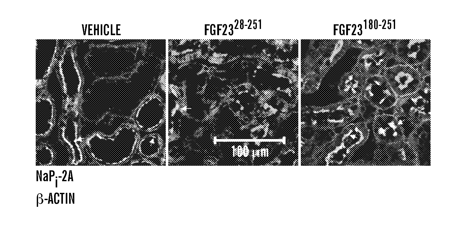 Inhibiting binding of fgf23 to the binary fgfr-klotho complex for the treatment of hypophosphatemia