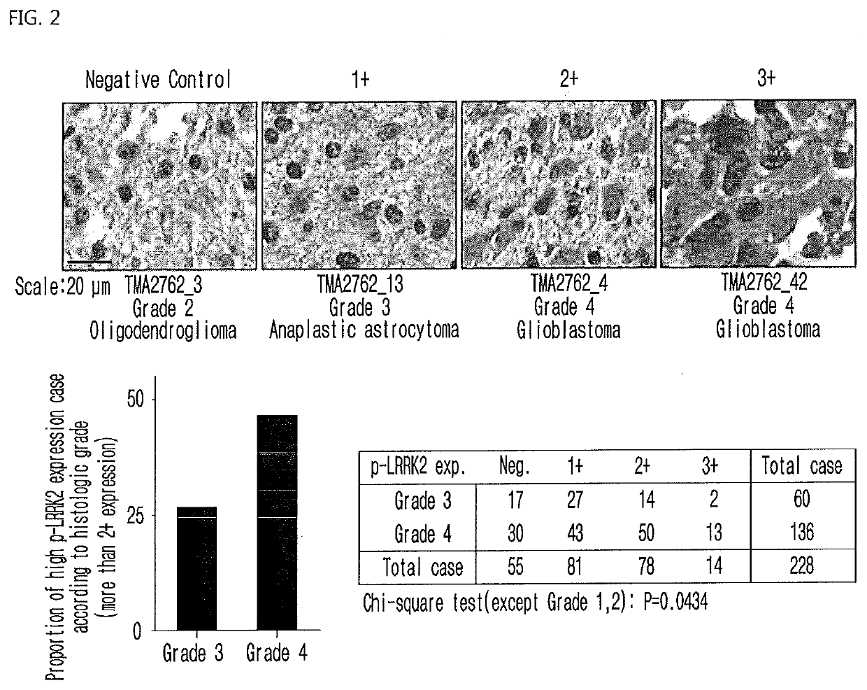 Pharmaceutical Composition Comprising Compound Capable of Penetrating Blood-Brain Barrier as Effective Ingredient for Preventing or Treating Brain Cancer