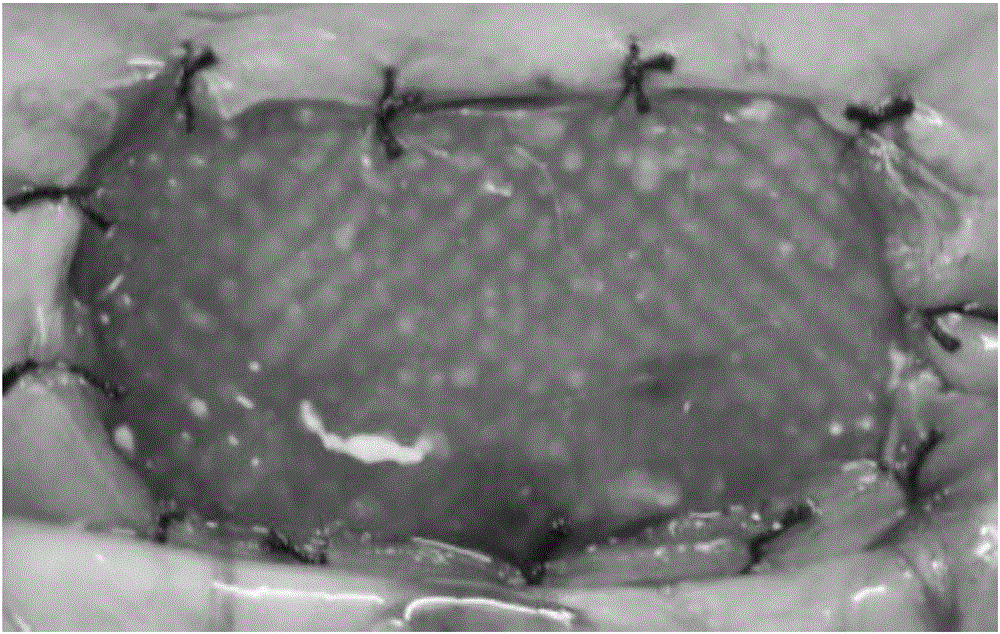 Composite tissue repair patch and preparation method and application thereof