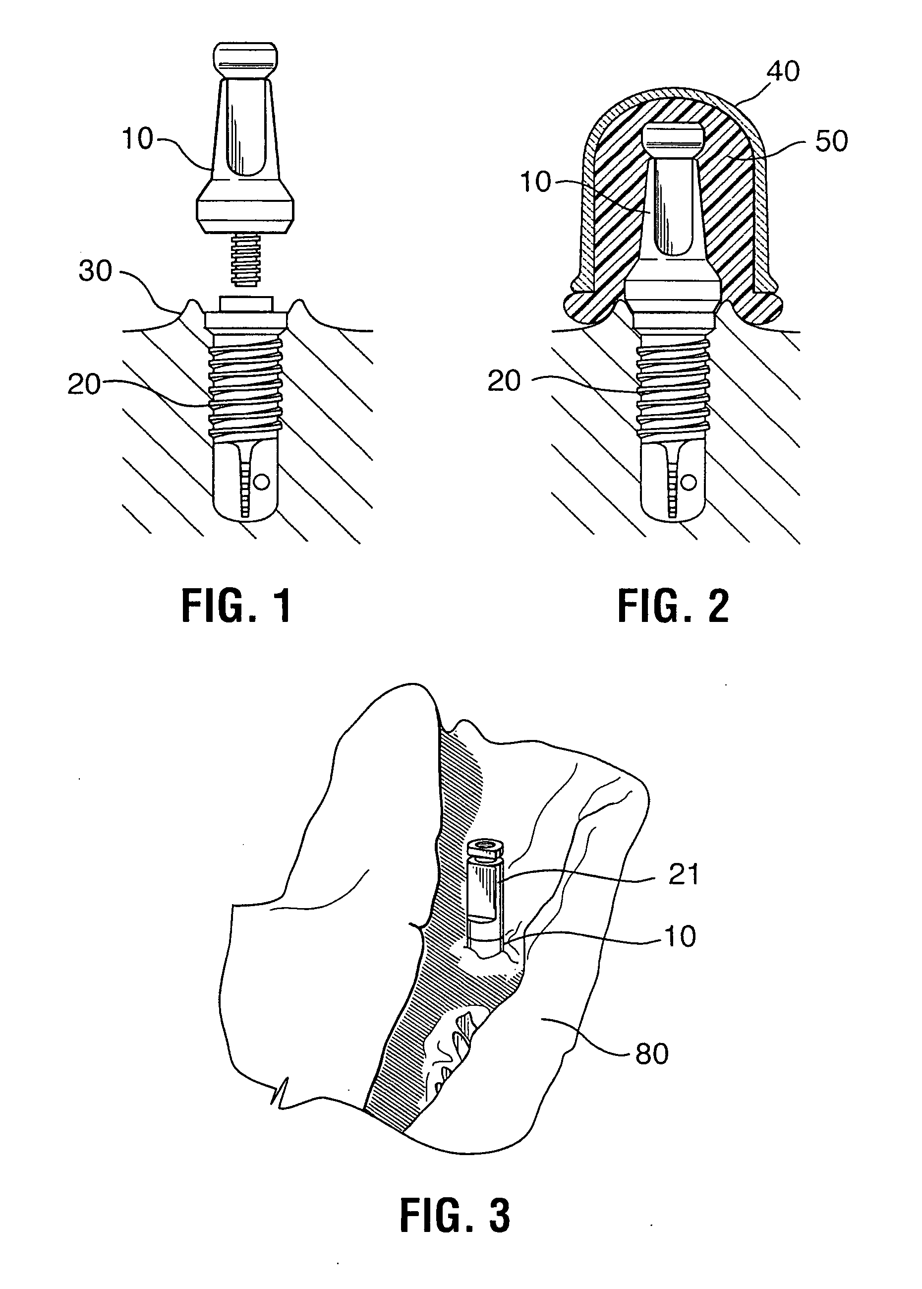 Soft tissue models and method of making for dental implant applications