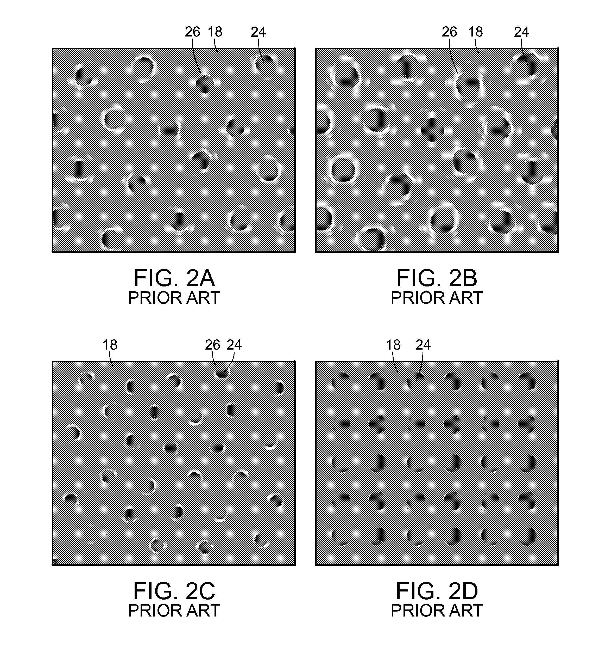 Subthreshold micropulse laser prophylactic treatment for chronic progressive retinal diseases