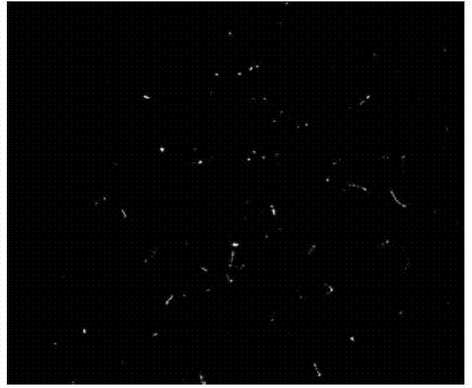 Double threshold blood vessel image processing method based on random direction histogram ratio