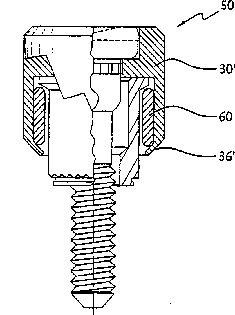 Jacking screw