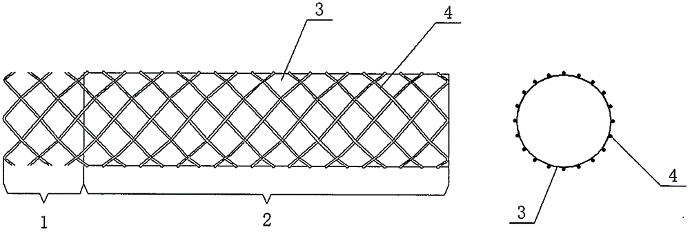 Venous type bracket partly covered by film