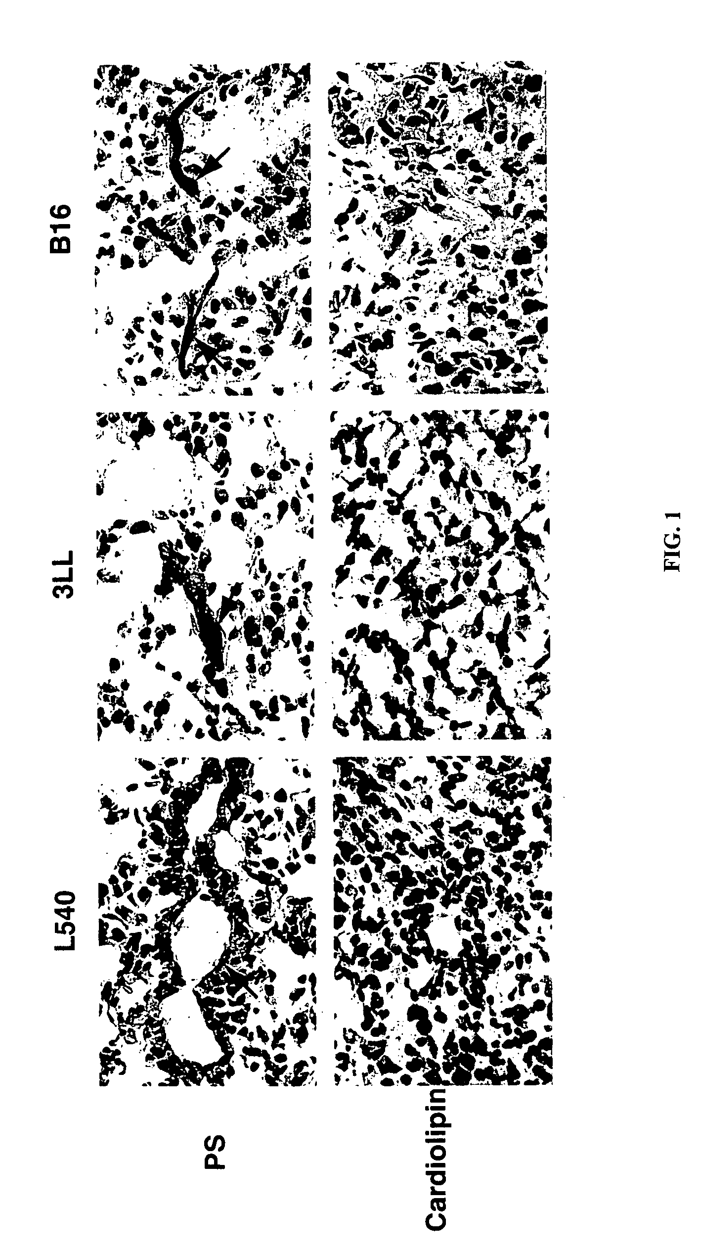 Compositions and methods for treating viral infections using antibodies and immunoconjugates to aminophospholipids