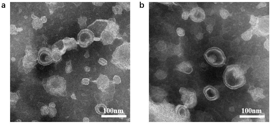 Vesicle for treating diseases caused by helicobacter pylori