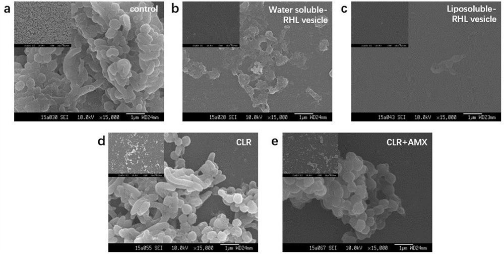 Vesicle for treating diseases caused by helicobacter pylori