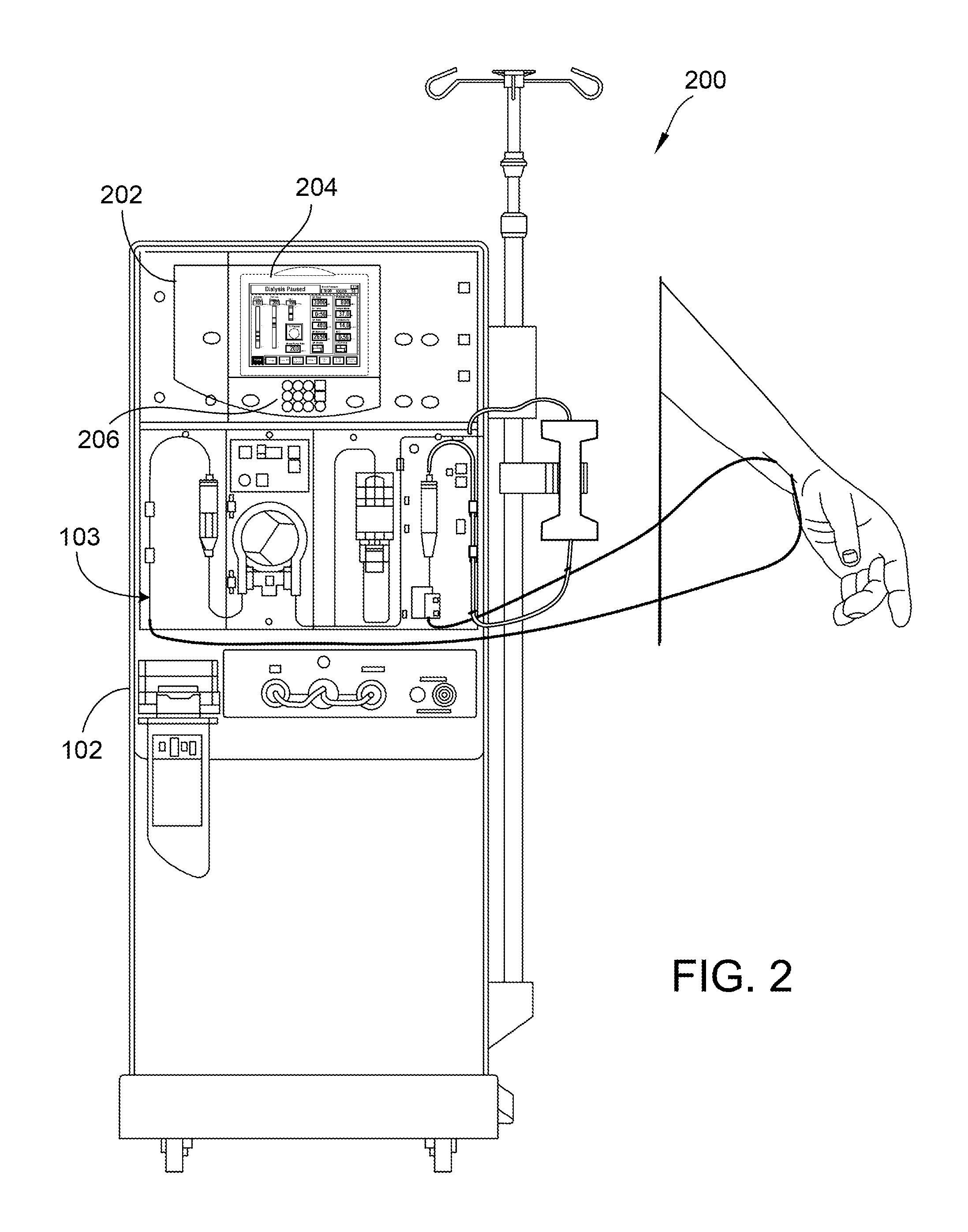 Remote control of dialysis machines