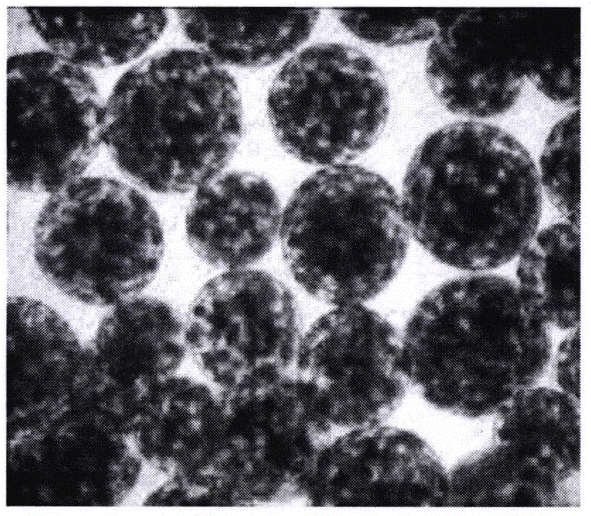 Probiotics microcapsule preparation and preparation method thereof