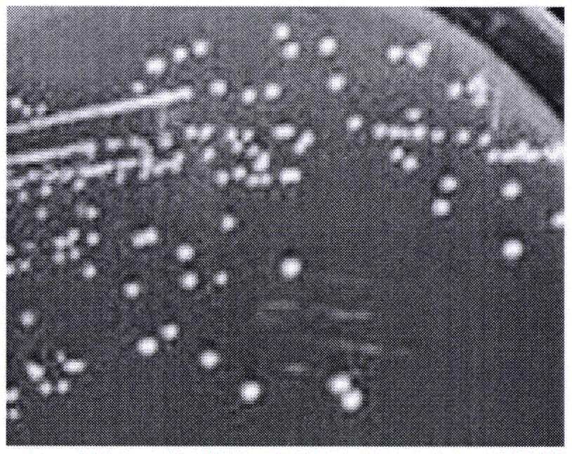 Probiotics microcapsule preparation and preparation method thereof