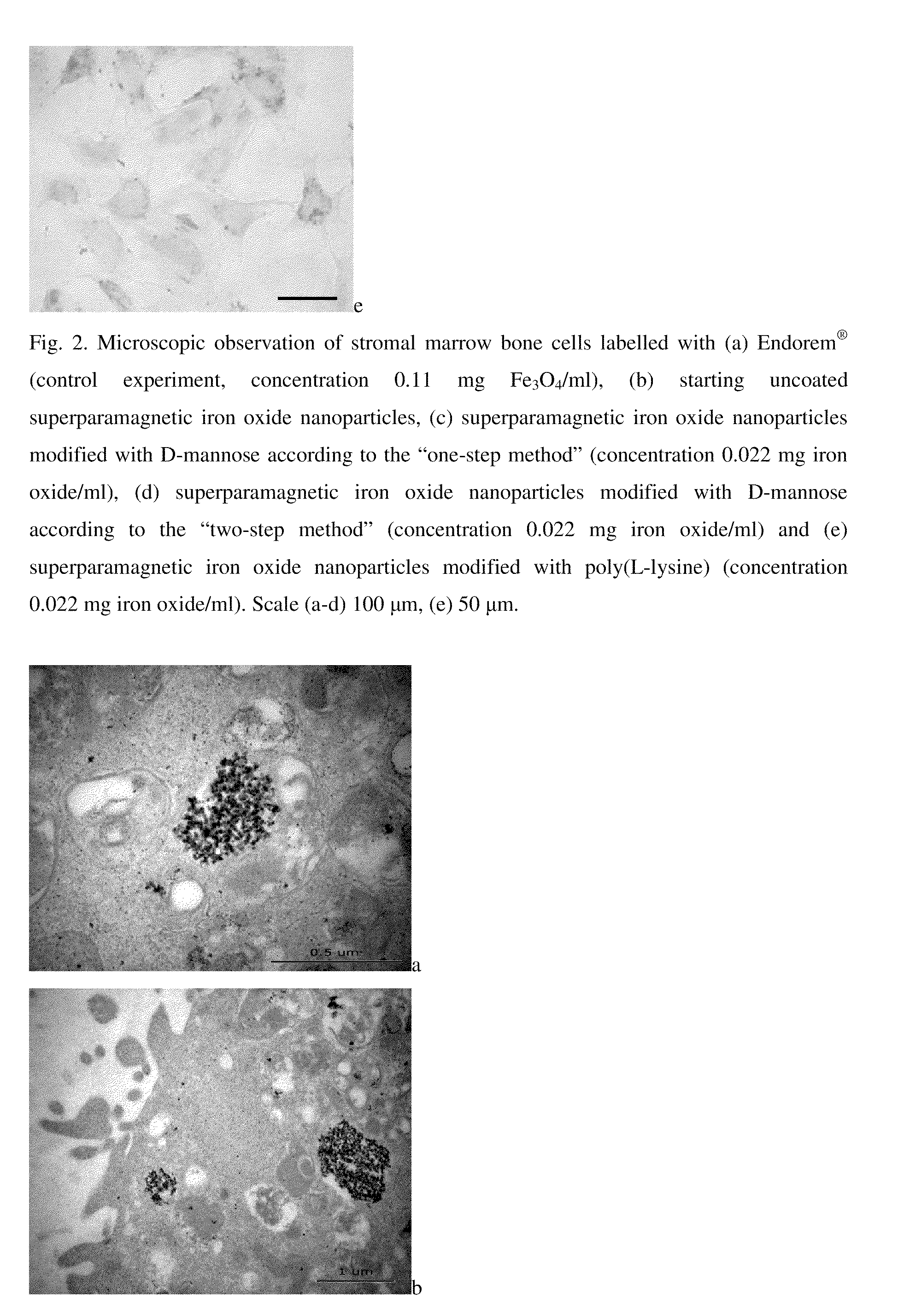 Superparamagnetic Nanoparticles Based on Iron Oxides with Modified Surface, Method of Their Preparation and Application