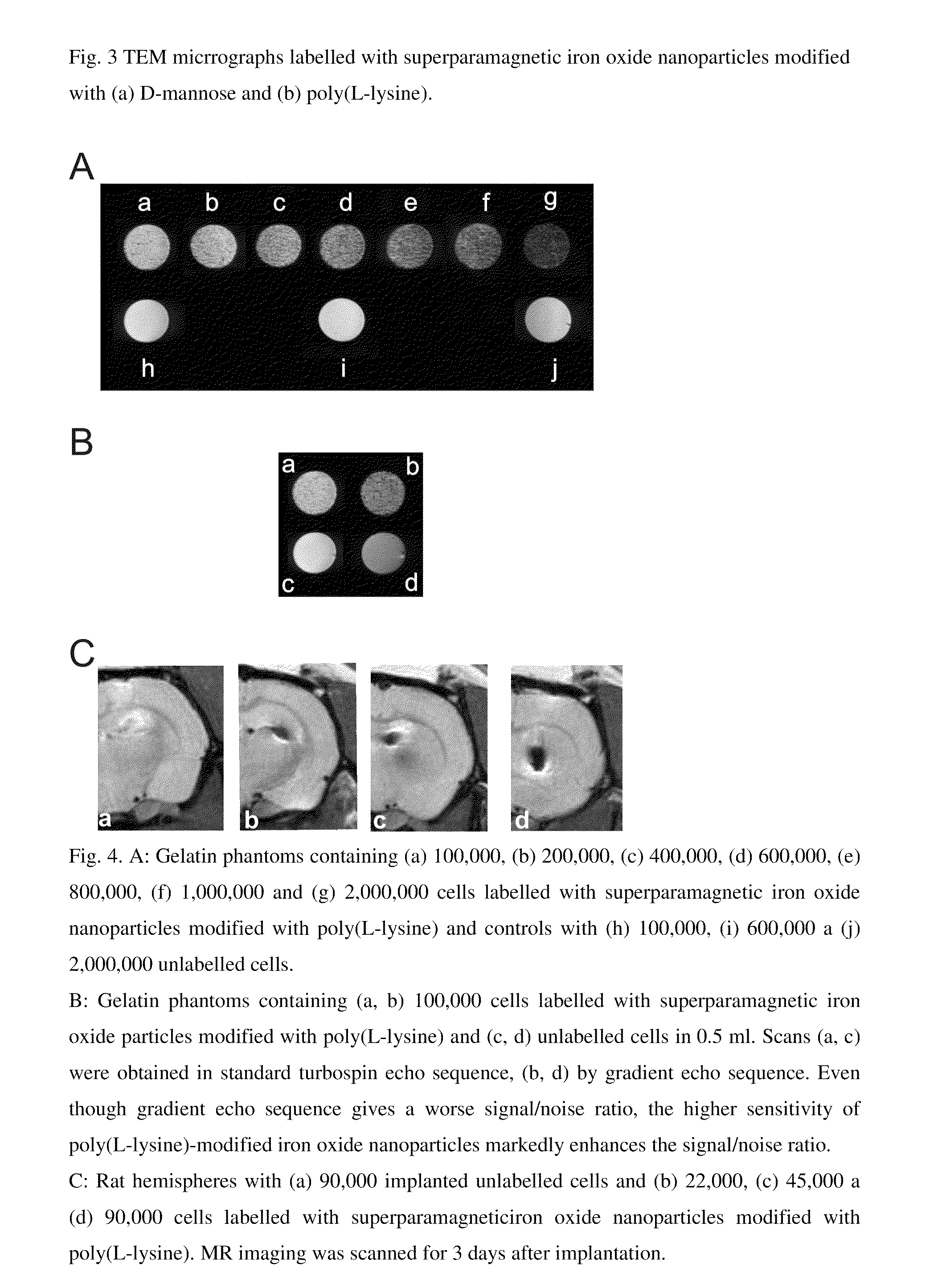 Superparamagnetic Nanoparticles Based on Iron Oxides with Modified Surface, Method of Their Preparation and Application