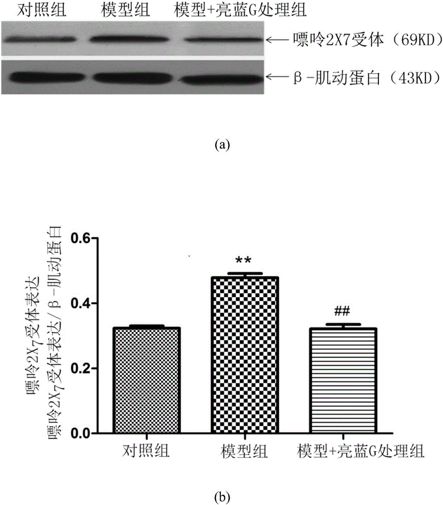 Application of brilliant blue G to preparation of drugs for human immunodeficiency virus glycoprotein 120 induced neuropathic pain