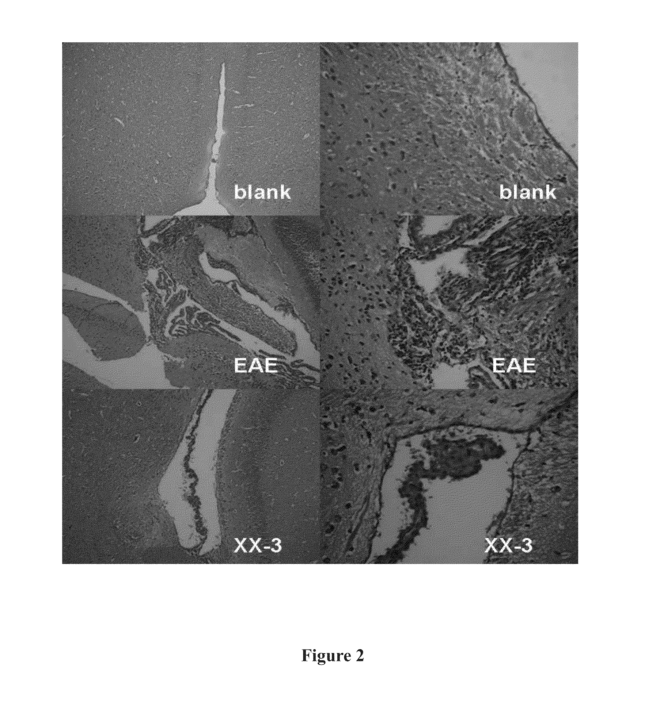 Line leaf inula flower lactone a and methods for preparing and using the same for treating multiple sclerosis