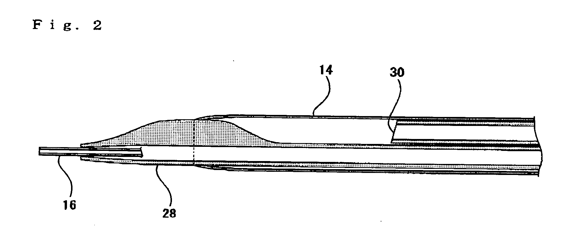 Catheter assembly and sheath tear assistant tool