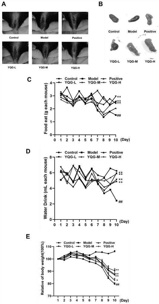 Application of medicine composition in preparation of medicine for treating inflammatory bowel disease